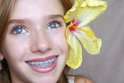 braces_girlflower